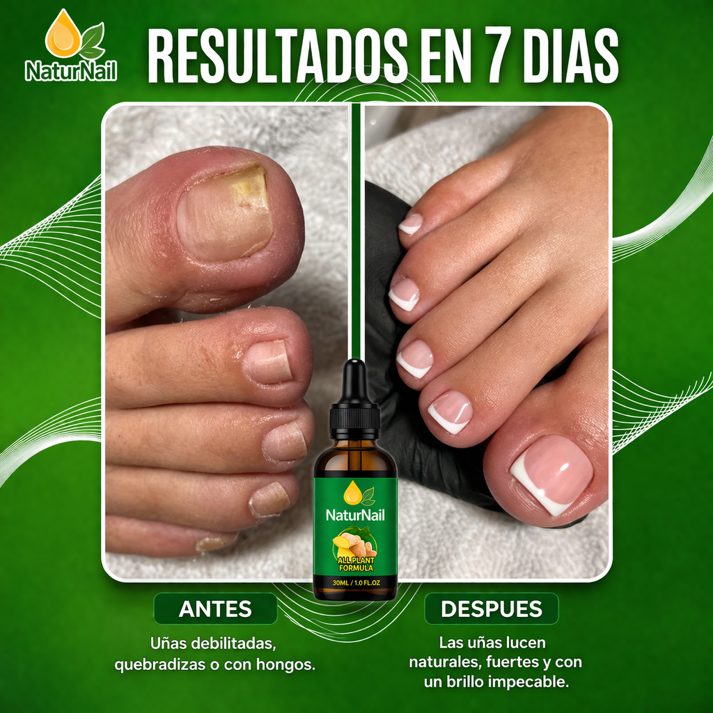 Naturnail tratamiento anti hongos 7 dias 100%  natural