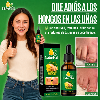 Naturnail tratamiento anti hongos 7 dias 100%  natural